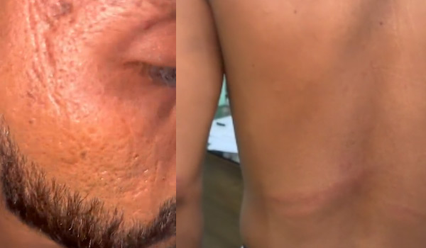 മാനസിക വെല്ലുവിളി നേരിടുന്ന യുവാവിനെ ക്രൂരമായി മര്‍ദിച്ചതായി പരാതി