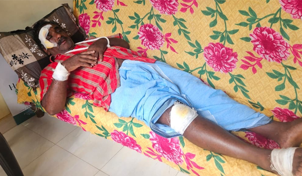 കാട്ടുപന്നി കൂറുകേ ചാടി; സ്‌കൂട്ടര്‍ യാത്രികന്  പരിക്കേറ്റു.